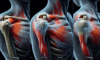 Acupuncture Techniques for Relieving Frozen Shoulder Pain