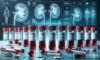 Kidney Blood Test Essentials for Blackburn Residents